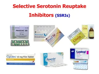 Selective Serotonin Reuptake Inhibitors (SSRIs)